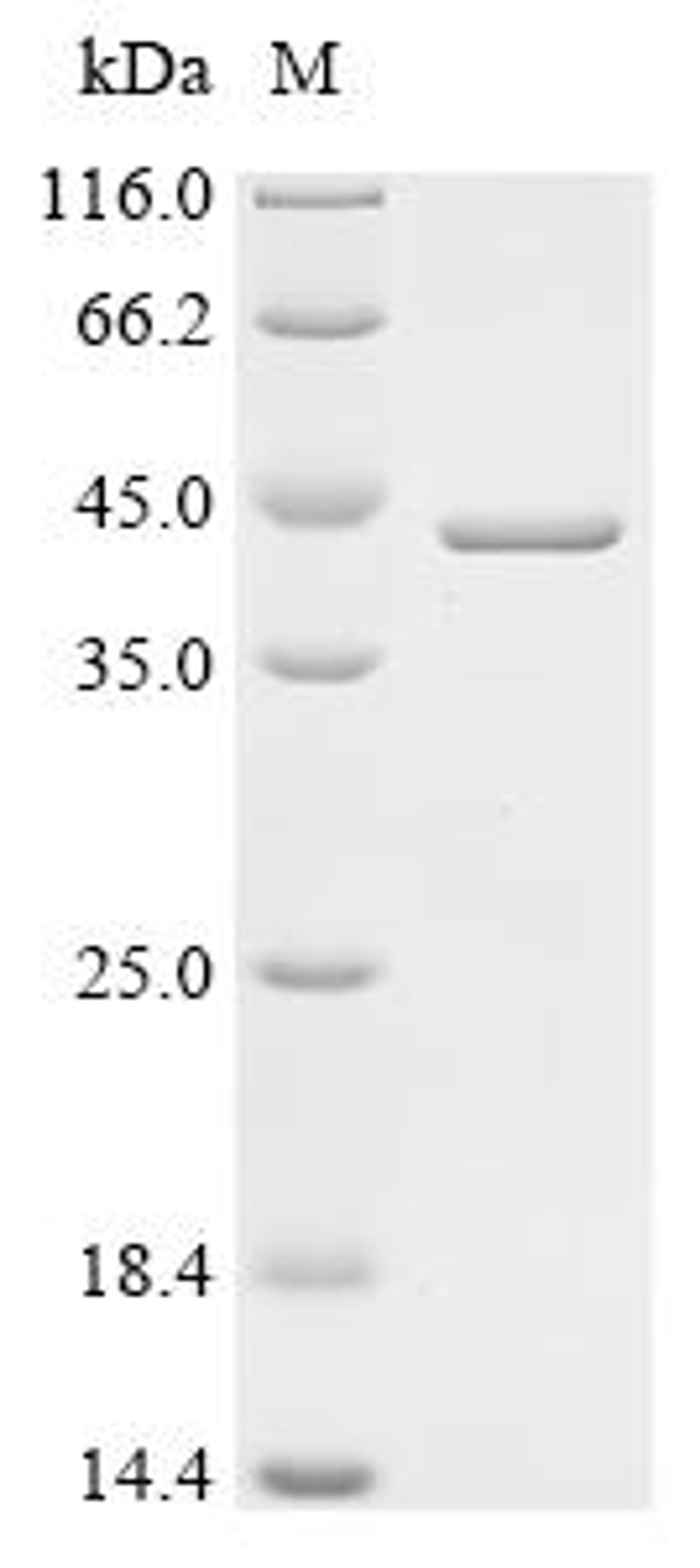 (Tris-Glycine gel) Discontinuous SDS-PAGE (reduced) with 5% enrichment gel and 15% separation gel.