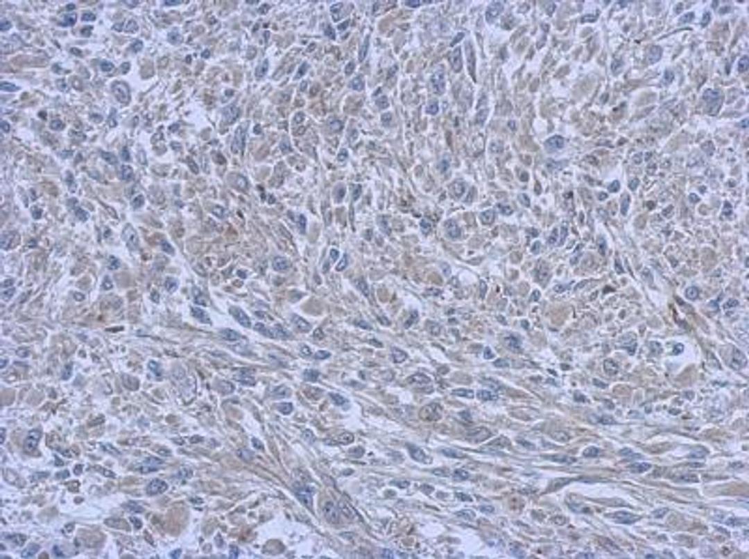 Immunohistochemistry-Paraffin: FCHO1 Antibody [NBP2-16458] - Immunohistochemical analysis of paraffin-embedded C2C12 xenograft, using antibody at 1:500 dilution.