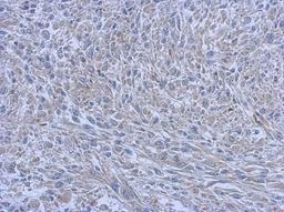 Immunohistochemistry-Paraffin: FCHO1 Antibody [NBP2-16458] - Immunohistochemical analysis of paraffin-embedded C2C12 xenograft, using antibody at 1:500 dilution.