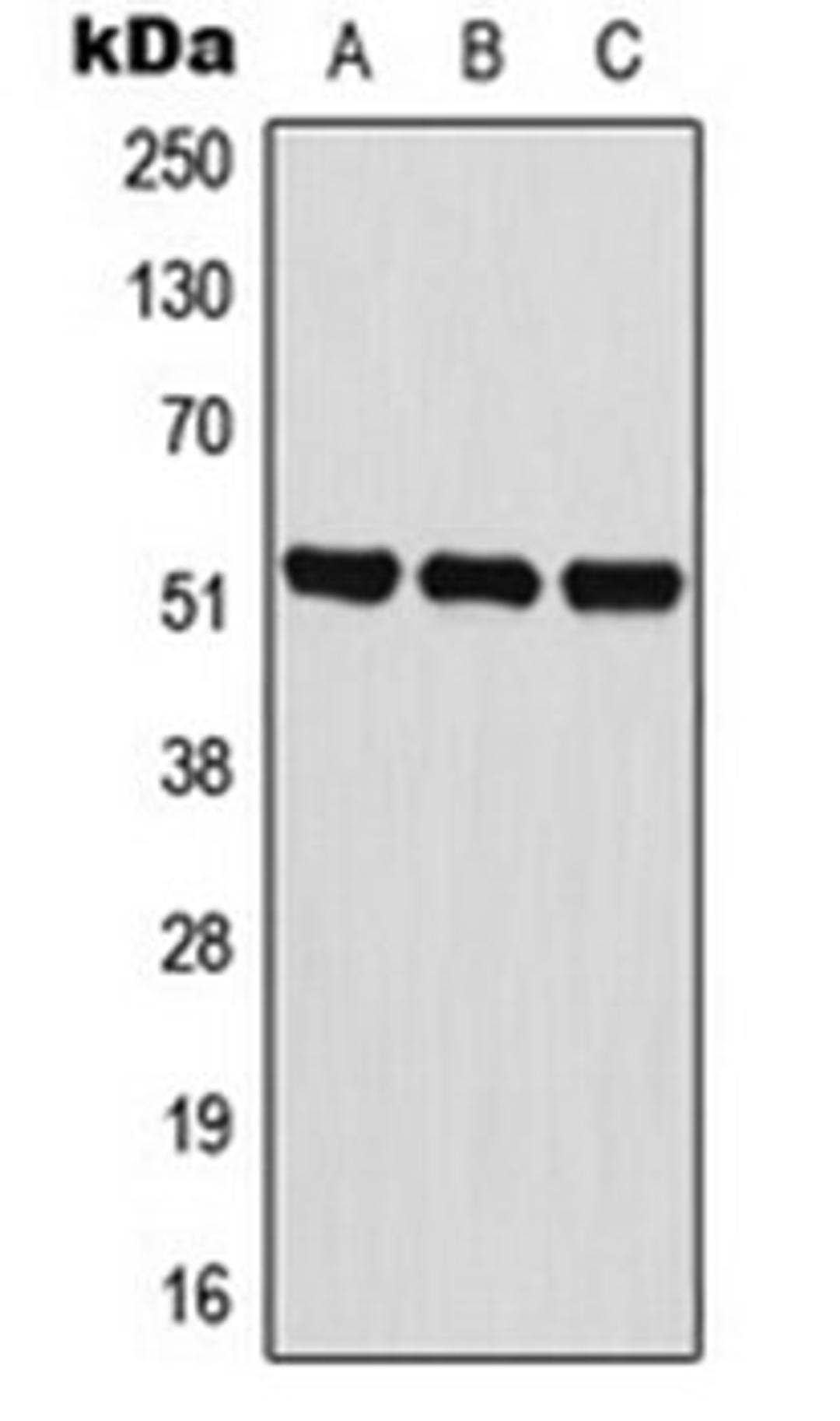 Western blot analysis of HeLa (Lane 1), HL60 (Lane 2), NIH3T3 (Lane 3) whole cell lysates using BAIAP2L2 antibody