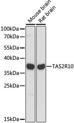 Western blot - TAS2R10 antibody (A15156)