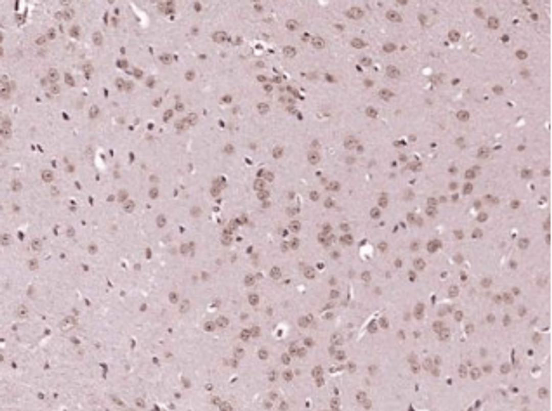 Immunohistochemical staining of mouse brain using IKK Alpha + IKK beta antibody