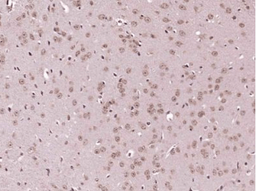 Immunohistochemical staining of mouse brain using IKK Alpha + IKK beta antibody