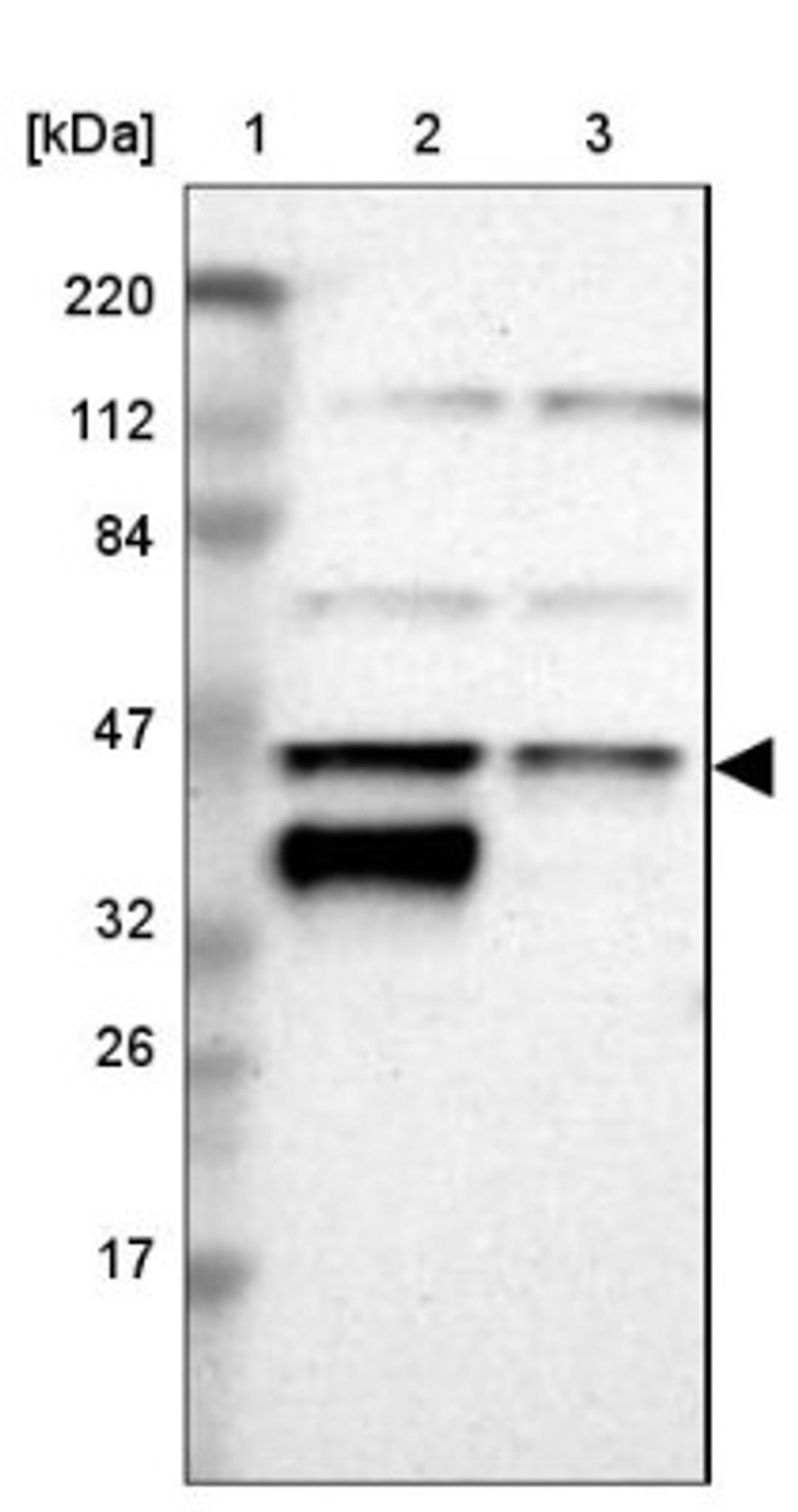 Western Blot: ASAH1 Antibody [NBP1-89296] - Lane 1: Marker [kDa] 220, 112, 84, 47, 32, 26, 17<br/>Lane 2: Human cell line RT-4<br/>Lane 3: Human cell line U-251MG sp