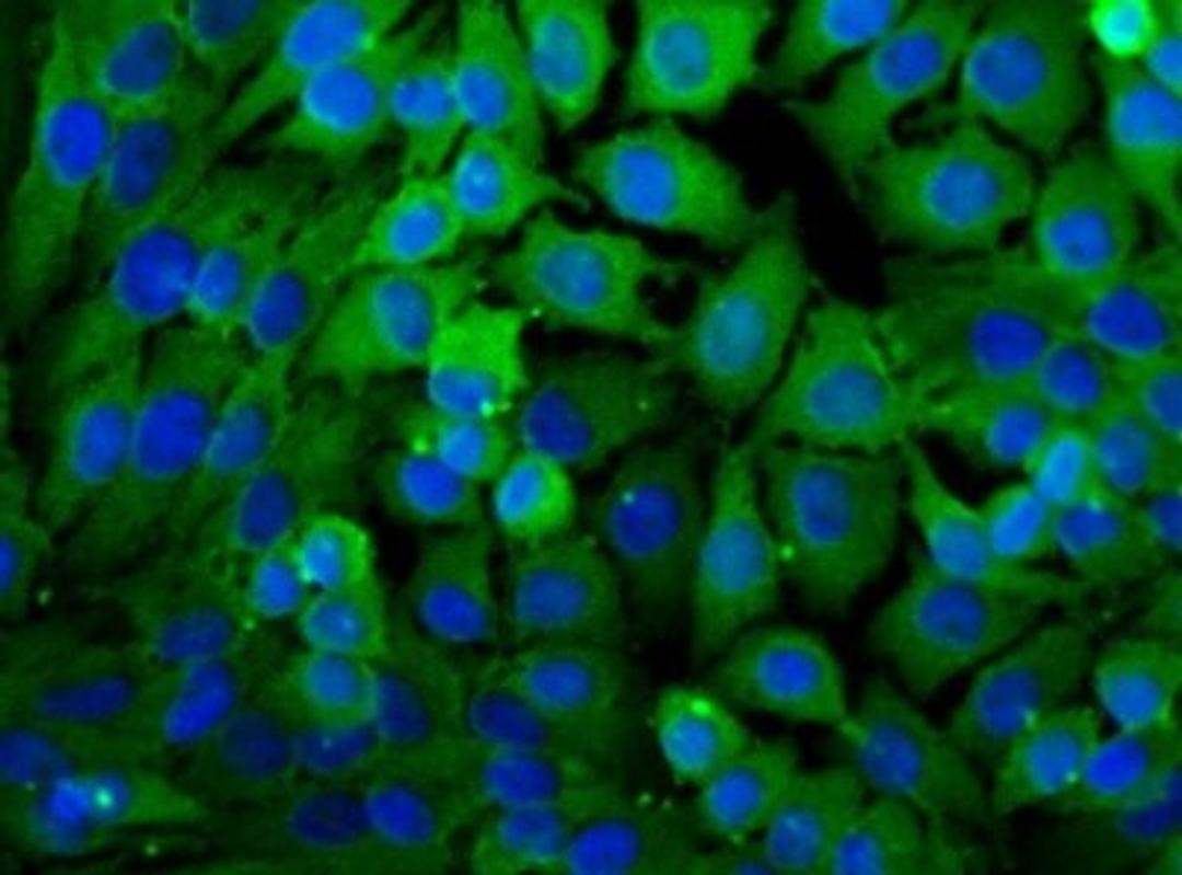 Immunocytochemistry/Immunofluorescence: Lactate Dehydrogenase A/LDHA Antibody [NBP1-48336] - Immunocytochemical analysis of Lactate Dehydrogenase A in HeLa cells