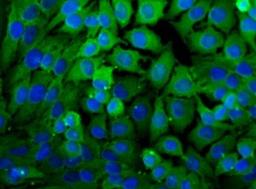 Immunocytochemistry/Immunofluorescence: Lactate Dehydrogenase A/LDHA Antibody [NBP1-48336] - Immunocytochemical analysis of Lactate Dehydrogenase A in HeLa cells