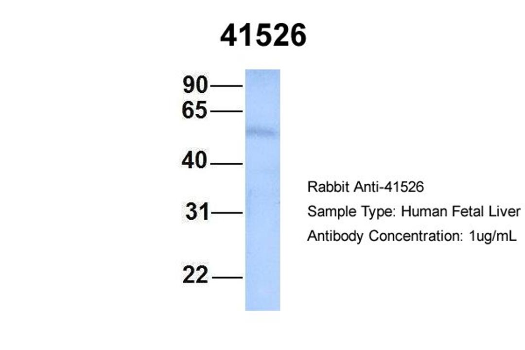 Antibody used in WB on Hum. Fetal Liver at 1 ug/ml.