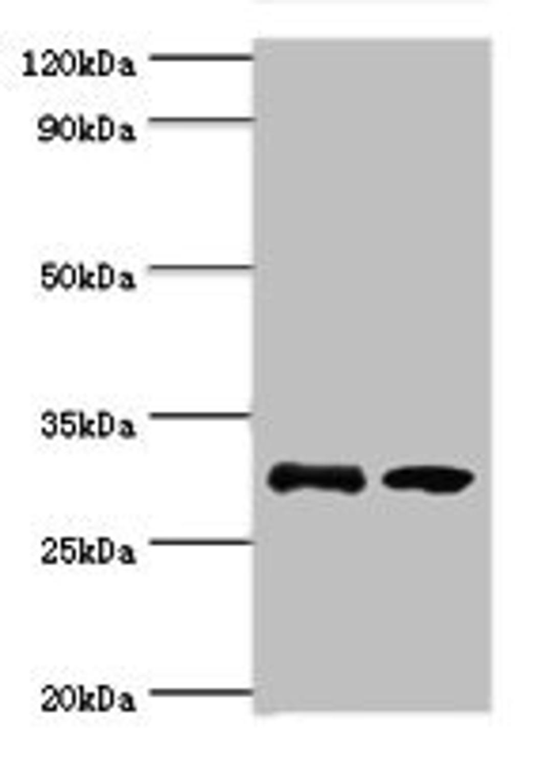 Western blot. All lanes: RPA4 antibody at 3ug/ml. Lane 1: K562 whole cell lysate. Lane 2: Mouse spleen tissue. Secondary. Goat polyclonal to rabbit IgG at 1/10000 dilution. Predicted band size: 29 kDa. Observed band size: 29 kDa.