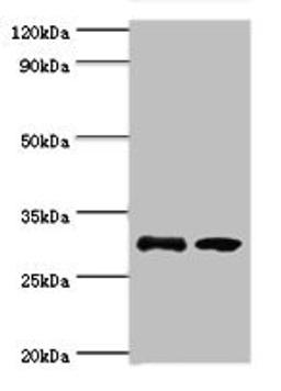 Western blot. All lanes: RPA4 antibody at 3ug/ml. Lane 1: K562 whole cell lysate. Lane 2: Mouse spleen tissue. Secondary. Goat polyclonal to rabbit IgG at 1/10000 dilution. Predicted band size: 29 kDa. Observed band size: 29 kDa.