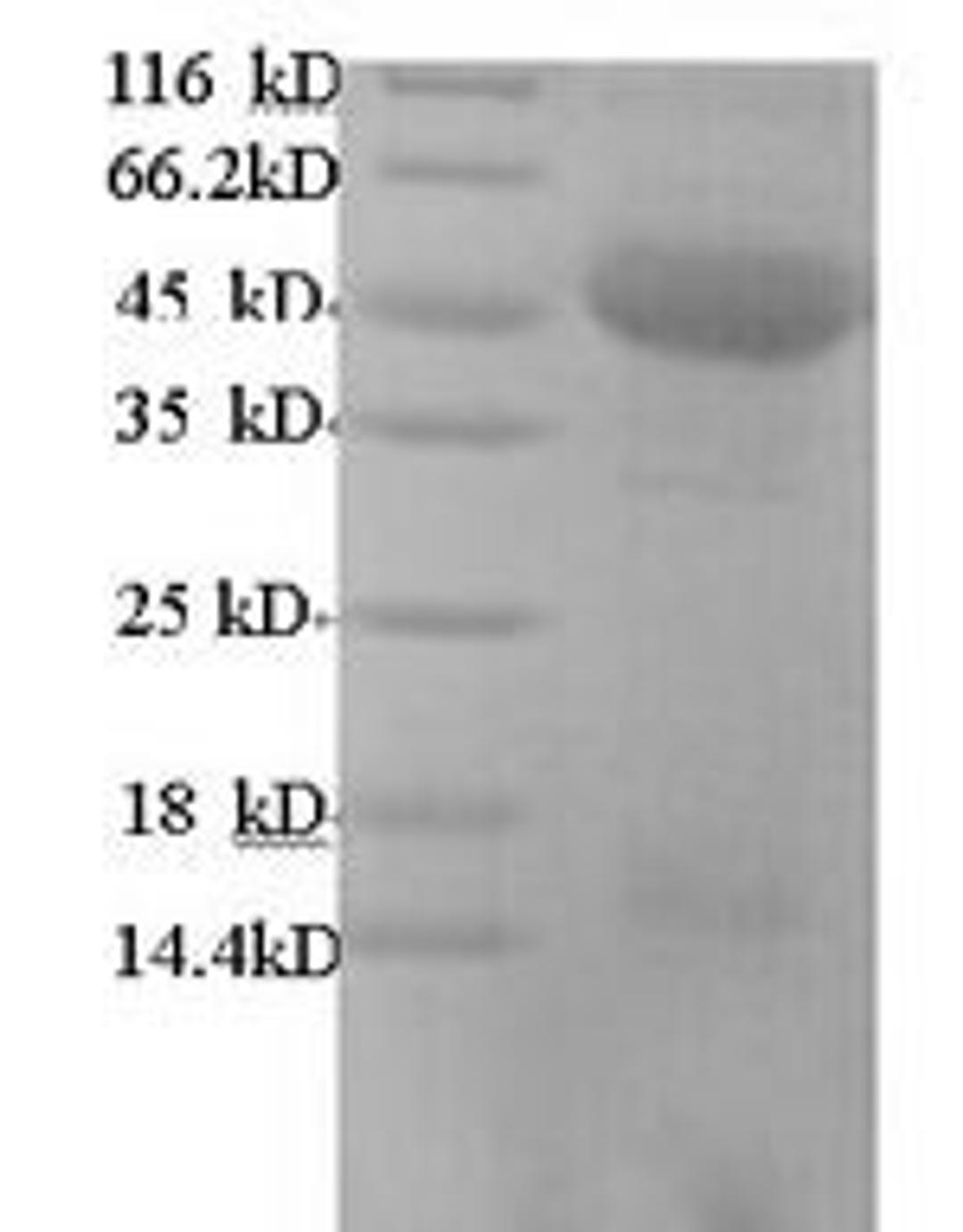 (Tris-Glycine gel) Discontinuous SDS-PAGE (reduced) with 5% enrichment gel and 15% separation gel.