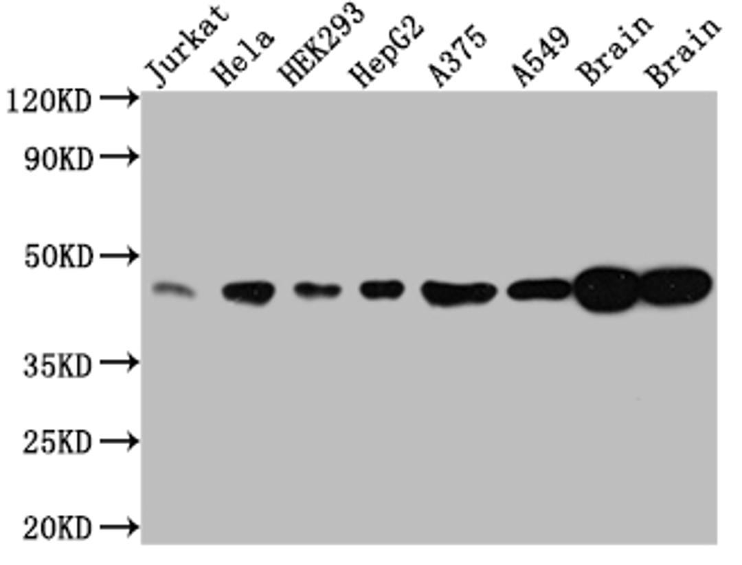 Western Blot. Positive WB detected in: Jurkat whole cell lysate, Hela whole cell lysate, HEK293 whole cell lysate, HepG2 whole cell lysate, A375 whole cell lysate, A549 whole cell lysate, Rat Brain whole cell lysate, Mouse Brain whole cell lysate. All lanes: ERK2 antibody at 1:1000. Secondary. Goat polyclonal to rabbit IgG at 1/50000 dilution. Predicted band size: 42, 37 kDa. Observed band size: 42 kDa.