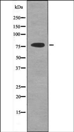 Western blot analysis of Jurkat whole cell lysates using PKCT -Phospho-Tyr90- antibody