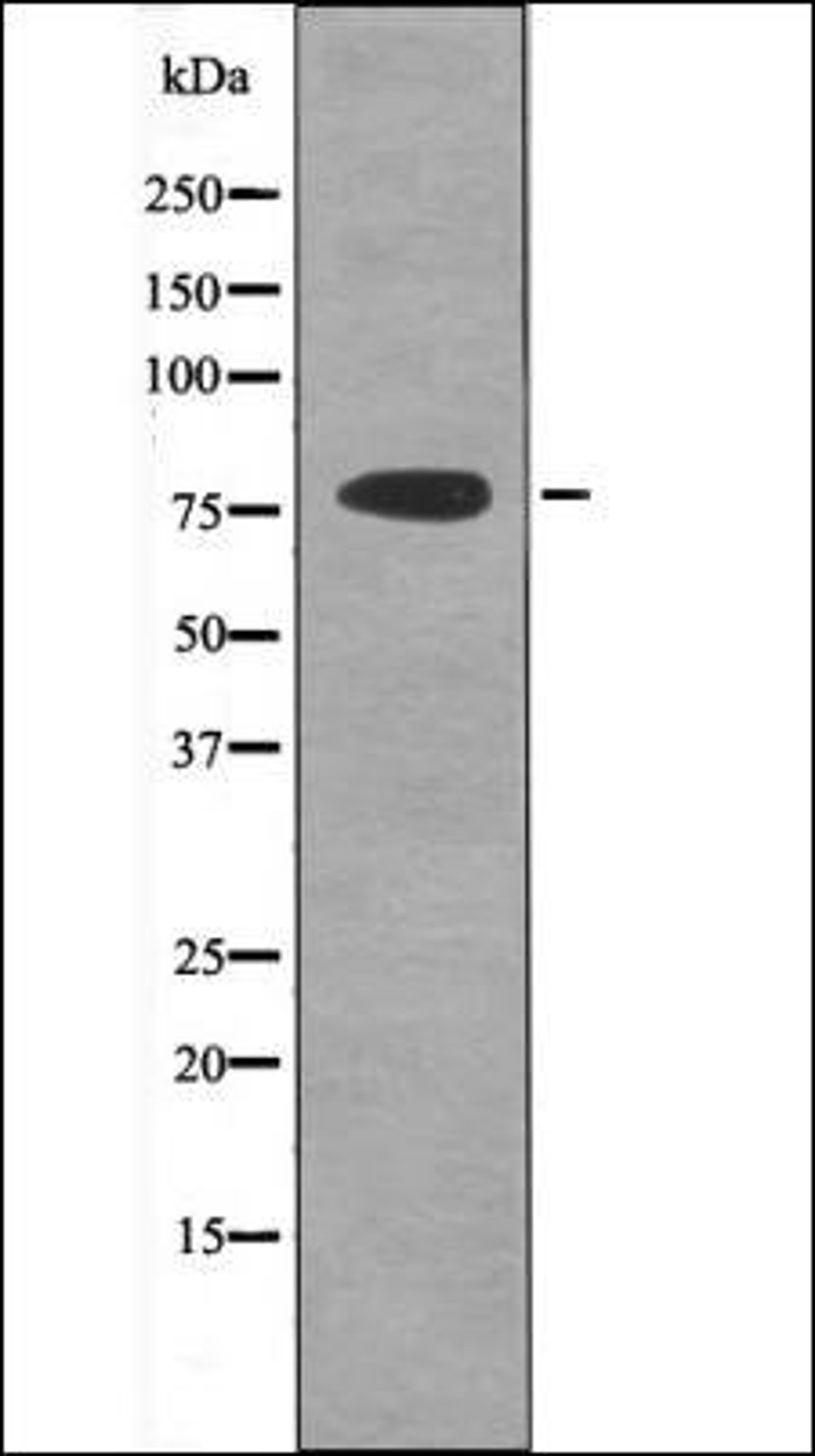 Western blot analysis of Jurkat whole cell lysates using PKCT -Phospho-Tyr90- antibody