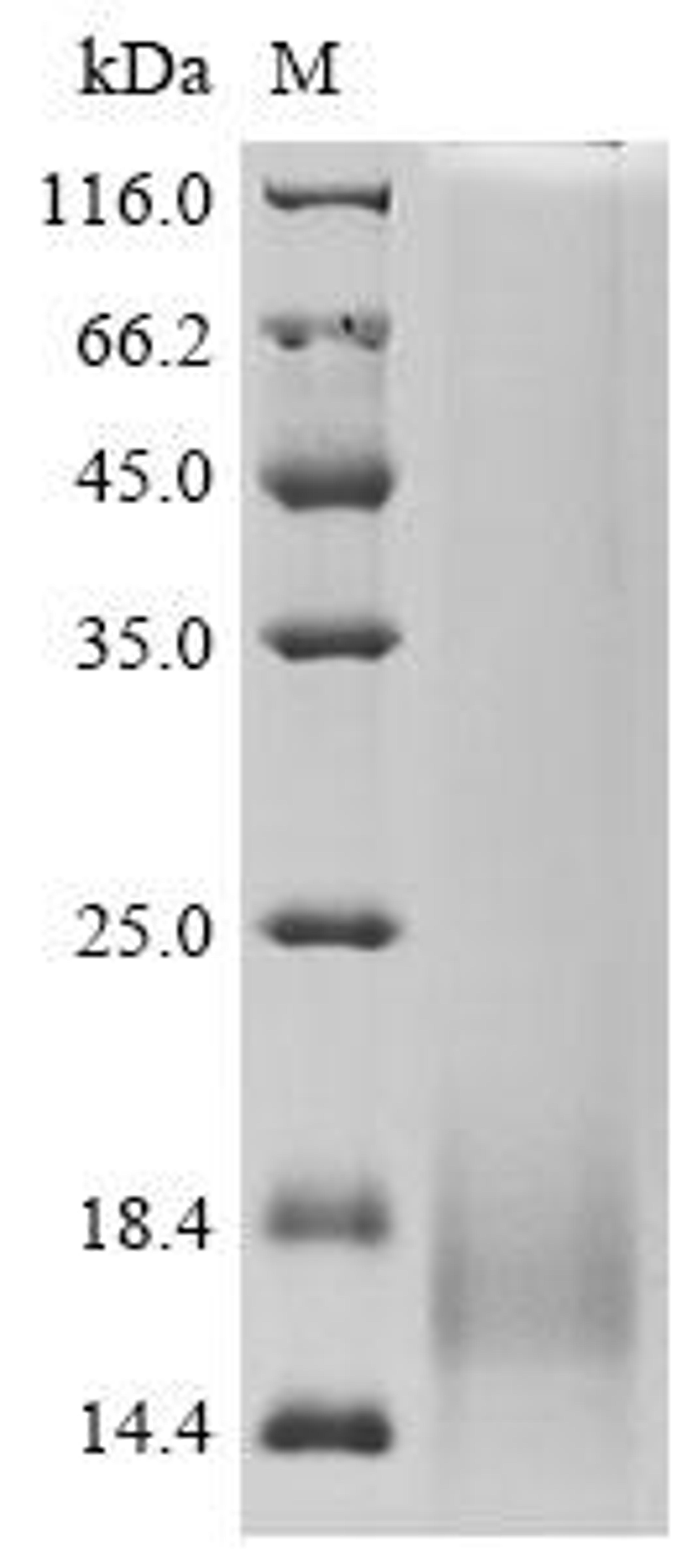 (Tris-Glycine gel) Discontinuous SDS-PAGE (reduced) with 5% enrichment gel and 15% separation gel.