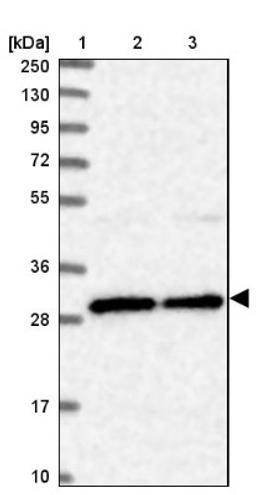 Western Blot: BCDIN3D Antibody [NBP1-85857] - Lane 1: Marker [kDa] 250, 130, 95, 72, 55, 36, 28, 17, 10<br/>Lane 2: Human cell line RT-4<br/>Lane 3: Human cell line U-251MG sp