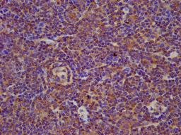 IHC image of CSB-PA002701LA01HU diluted at 1:100 and staining in paraffin-embedded human lymph node tissue performed on a Leica BondTM system. After dewaxing and hydration, antigen retrieval was mediated by high pressure in a citrate buffer (pH 6.0). Section was blocked with 10% normal goat serum 30min at RT. Then primary antibody (1% BSA) was incubated at 4°C overnight. The primary is detected by a biotinylated secondary antibody and visualized using an HRP conjugated SP system.