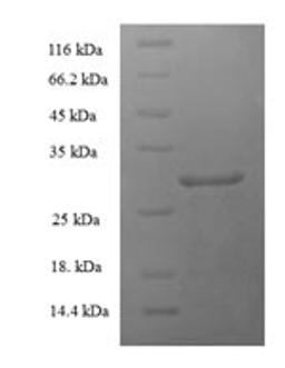 (Tris-Glycine gel) Discontinuous SDS-PAGE (reduced) with 5% enrichment gel and 15% separation gel.