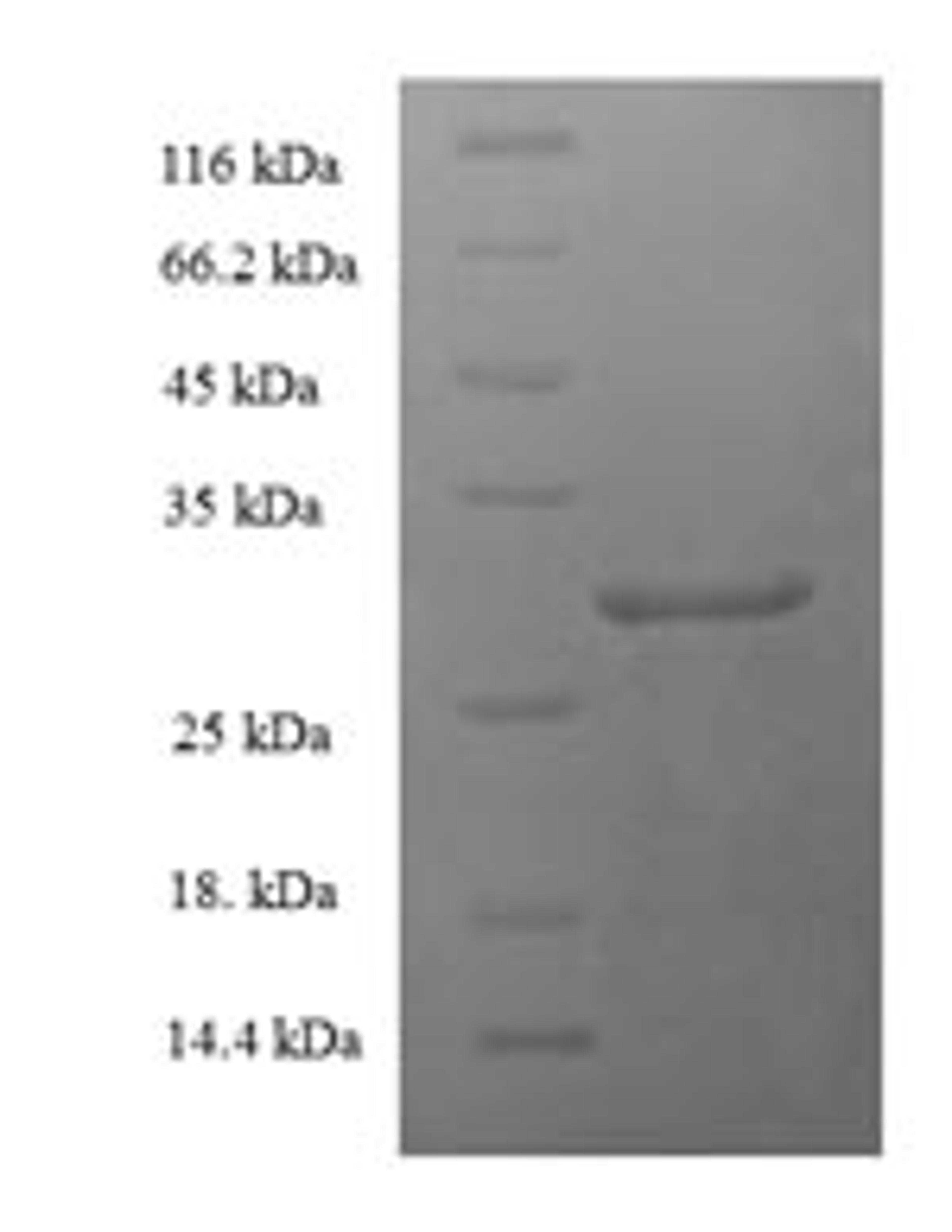 (Tris-Glycine gel) Discontinuous SDS-PAGE (reduced) with 5% enrichment gel and 15% separation gel.