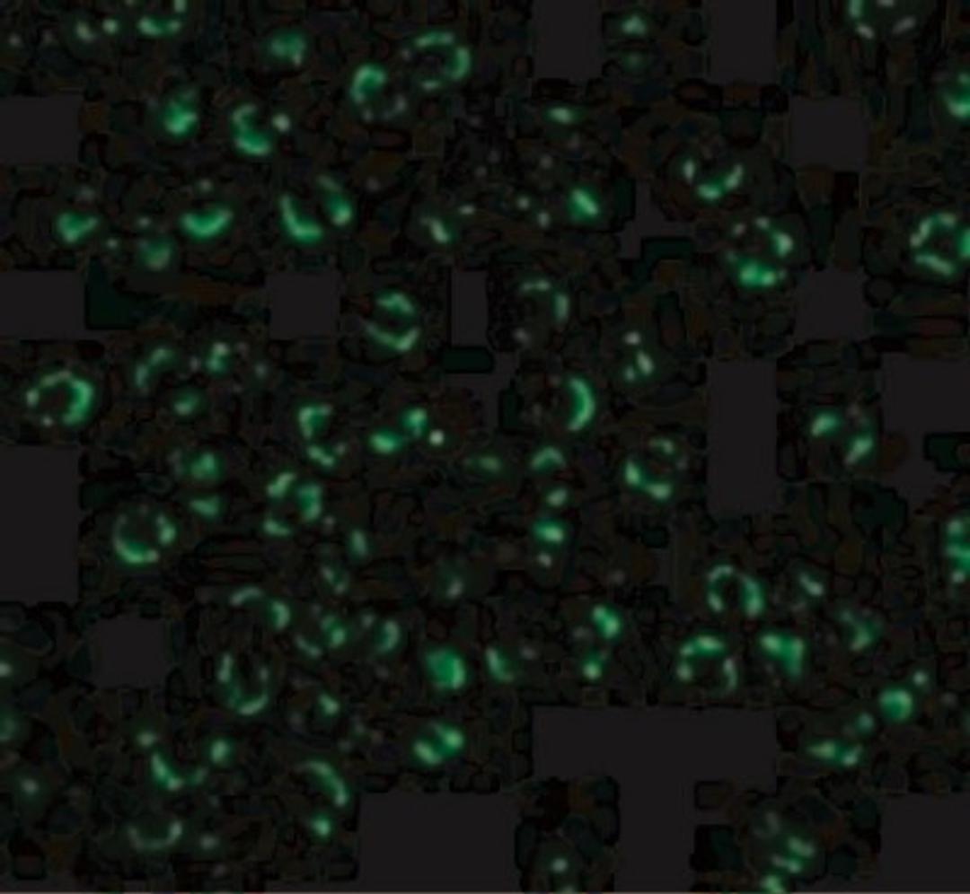 Immunofluorescence: RIPK2 Antibody [NBP1-76873] - Immunofluorescence of RICK in K562 cells with RICK antibody at 20 ug/mL.