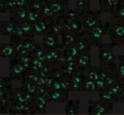 Immunofluorescence: RIPK2 Antibody [NBP1-76873] - Immunofluorescence of RICK in K562 cells with RICK antibody at 20 ug/mL.