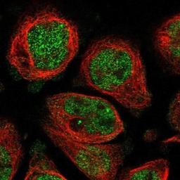 Immunocytochemistry: C21orf58 Antibody [NBP1-85912] - Immunofluorescence:  [NBP1-85912] - Immunofluorescent staining of human cell line A-431 shows positivity in nucleus but not nucleoli.