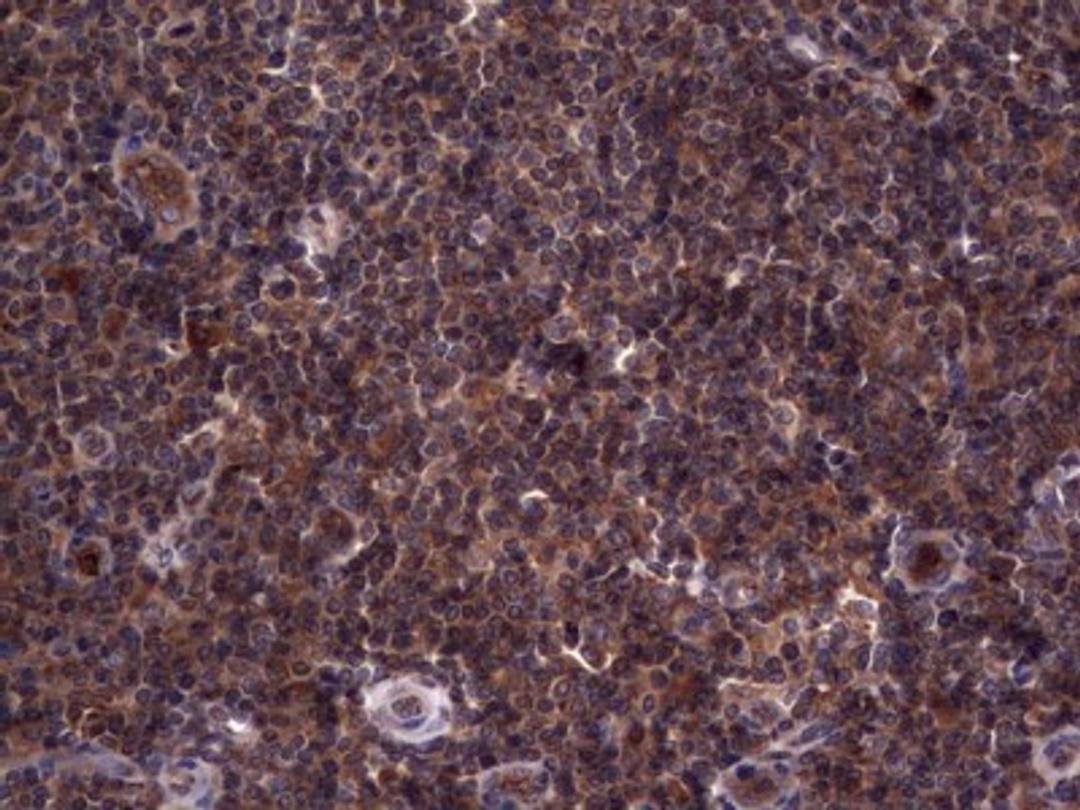 Immunohistochemistry: R-Spondin 3 Antibody (3D5) [NBP2-45637] - Analysis of Human tonsil tissue. (Heat-induced epitope retrieval by 1 mM EDTA in 10mM Tris, pH8.5, 120C for 3min)