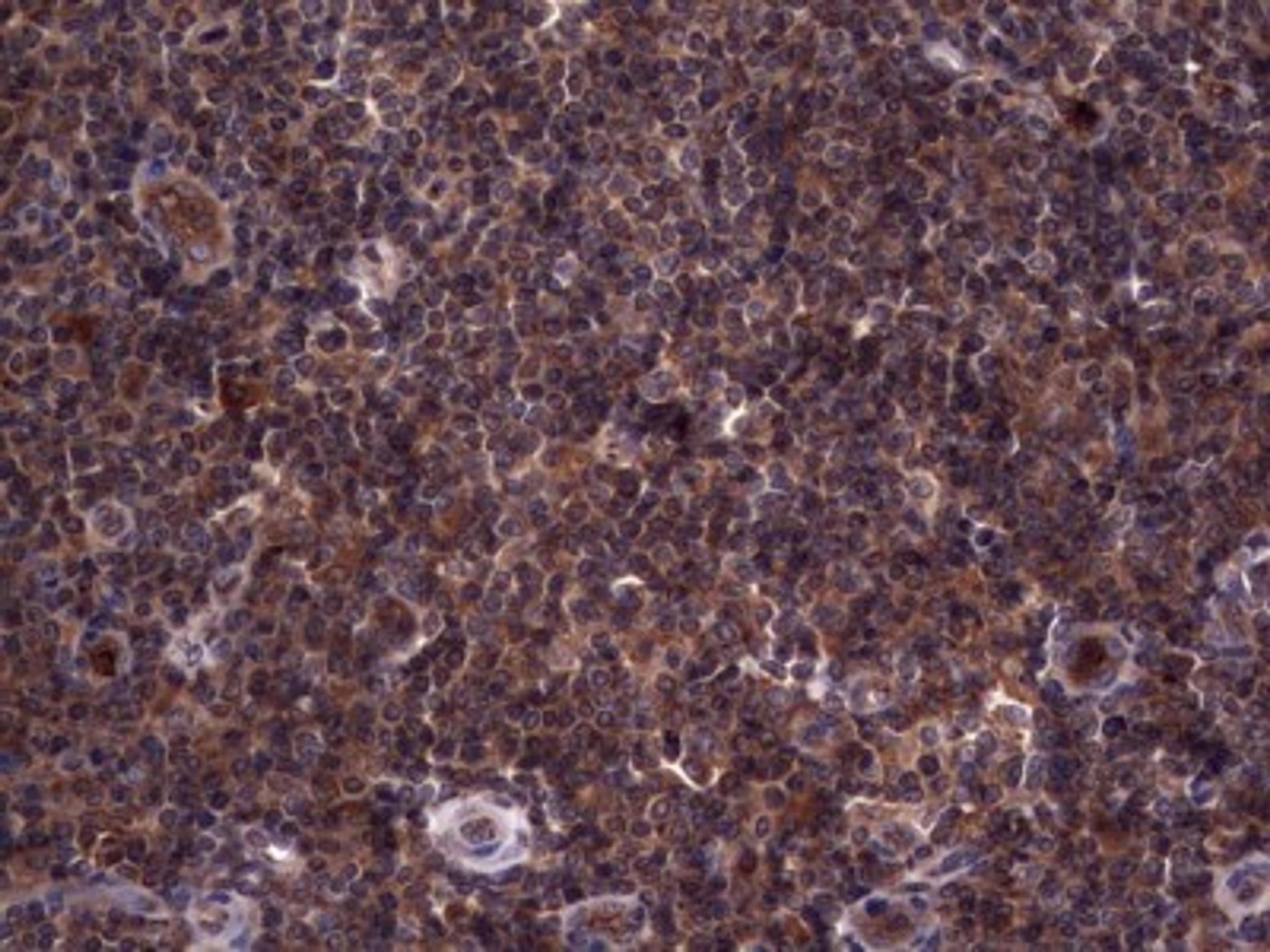 Immunohistochemistry: R-Spondin 3 Antibody (3D5) [NBP2-45637] - Analysis of Human tonsil tissue. (Heat-induced epitope retrieval by 1 mM EDTA in 10mM Tris, pH8.5, 120C for 3min)