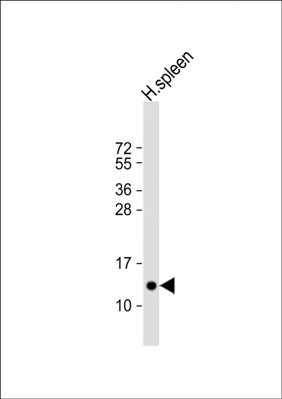 Western Blot at 1:2000 dilution + human spleen lysate Lysates/proteins at 20 ug per lane.