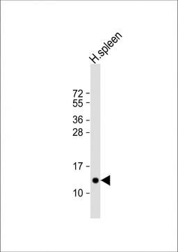 Western Blot at 1:2000 dilution + human spleen lysate Lysates/proteins at 20 ug per lane.