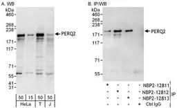 Immunoprecipitation: PERQ2 Antibody [NBP2-12812] -  Samples:  Whole cell lysate from HeLa (15 and 50 ug for WB; 1 mg for IP, 20% of IP loaded), 293T (T; 50 ug) and Jurkat (J; 50 ug) cells.  Antibodies: Affinity purified rabbit anti-PERQ2 antibody NBP2-12811 used for WB at 0.1 ug/ml (A) and 1 ug/ml (B) and used for IP at 6 ug/mg lysate.  PERQ2 was also immunoprecipitated by rabbit anti-PERQ2 antibodies NBP2-12812 and NBP2-12813, which recognize downstream epitopes.  Detection: Chemiluminescence with exposure times of 10 seconds (A and B).