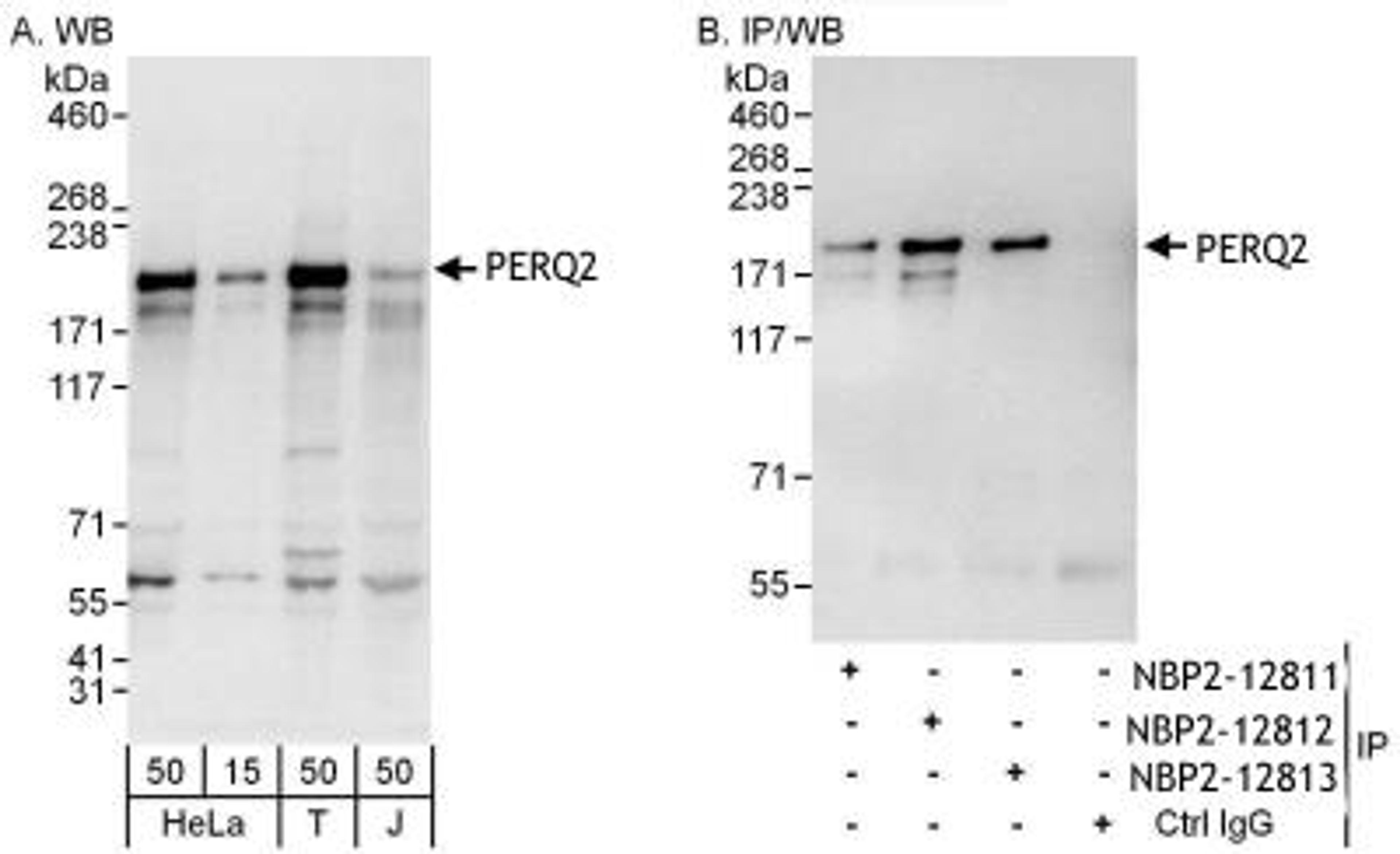 Immunoprecipitation: PERQ2 Antibody [NBP2-12812] -  Samples:  Whole cell lysate from HeLa (15 and 50 ug for WB; 1 mg for IP, 20% of IP loaded), 293T (T; 50 ug) and Jurkat (J; 50 ug) cells.  Antibodies: Affinity purified rabbit anti-PERQ2 antibody NBP2-12811 used for WB at 0.1 ug/ml (A) and 1 ug/ml (B) and used for IP at 6 ug/mg lysate.  PERQ2 was also immunoprecipitated by rabbit anti-PERQ2 antibodies NBP2-12812 and NBP2-12813, which recognize downstream epitopes.  Detection: Chemiluminescence with exposure times of 10 seconds (A and B).