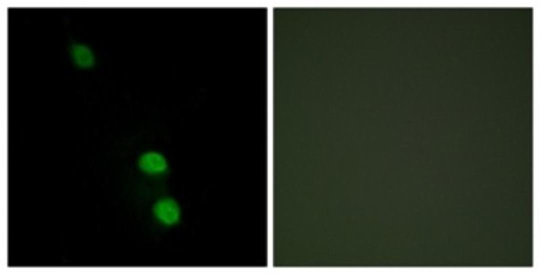 Immunocytochemistry/Immunofluorescence: TEAD2 Antibody [NBP1-55644] - Analysis of HepG2 cells, using TEAD2 Antibody. The picture on the right is treated with the synthesized peptide.