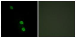 Immunocytochemistry/Immunofluorescence: TEAD2 Antibody [NBP1-55644] - Analysis of HepG2 cells, using TEAD2 Antibody. The picture on the right is treated with the synthesized peptide.