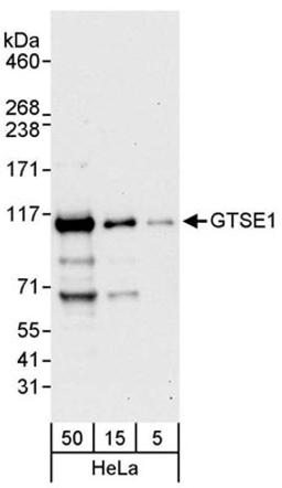 Detection of human GTSE1 by western blot.