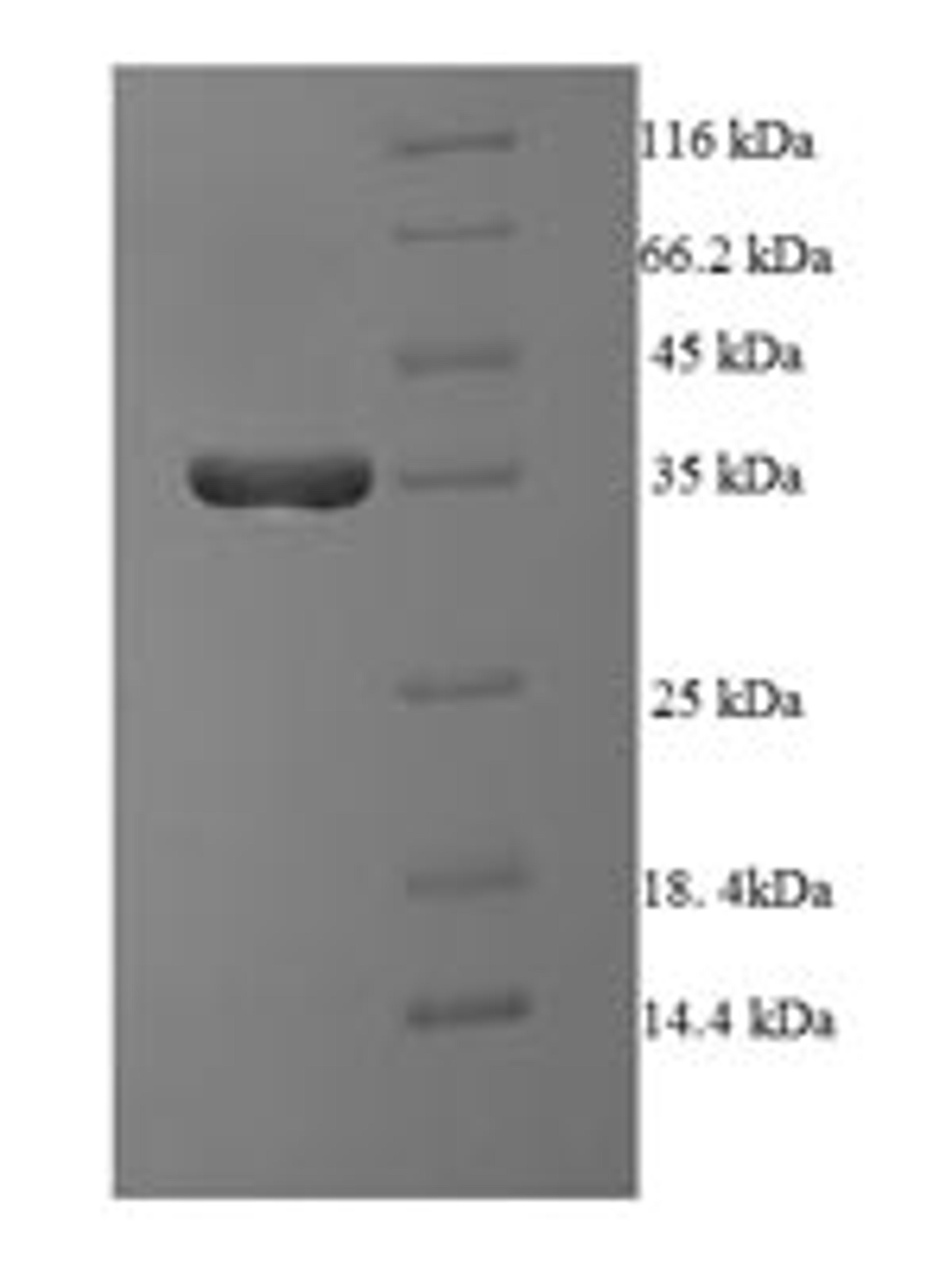 (Tris-Glycine gel) Discontinuous SDS-PAGE (reduced) with 5% enrichment gel and 15% separation gel.