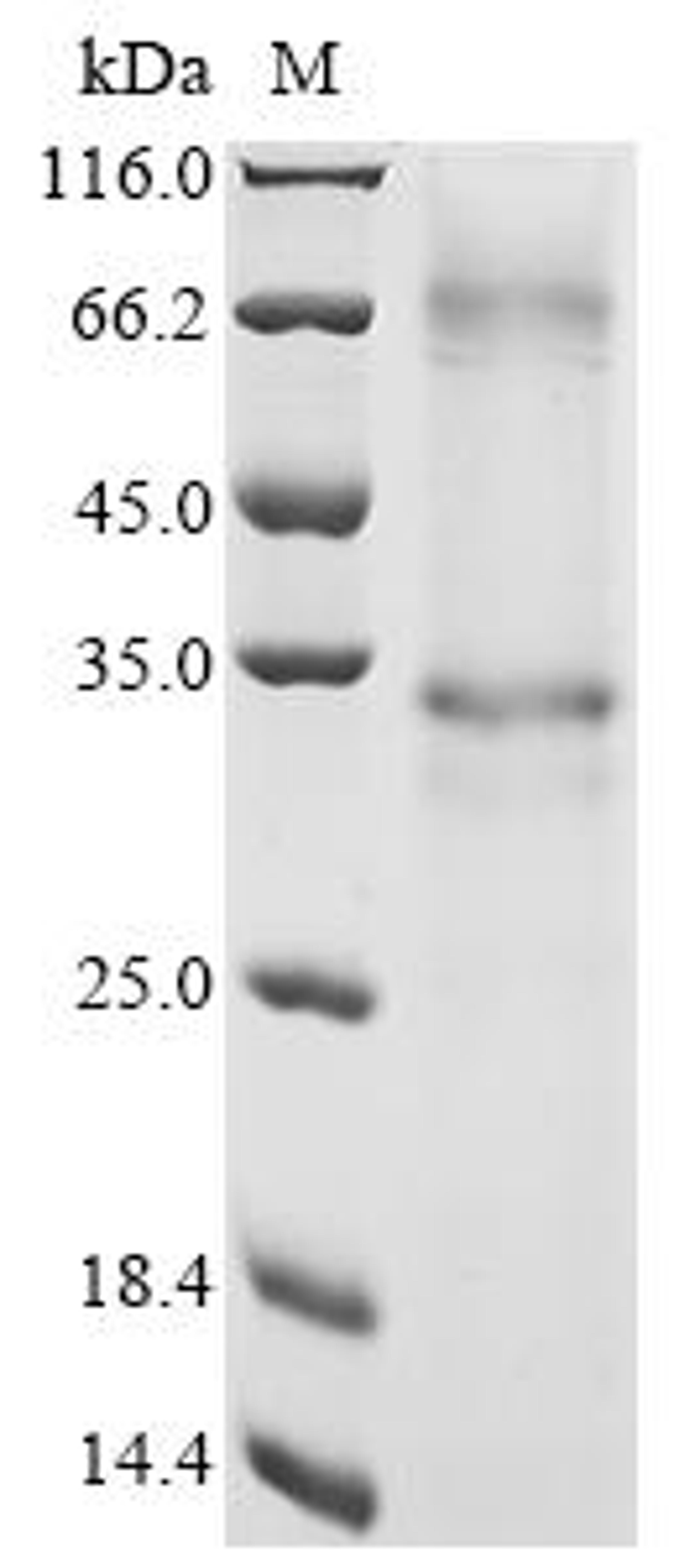 (Tris-Glycine gel) Discontinuous SDS-PAGE (reduced) with 5% enrichment gel and 15% separation gel.
