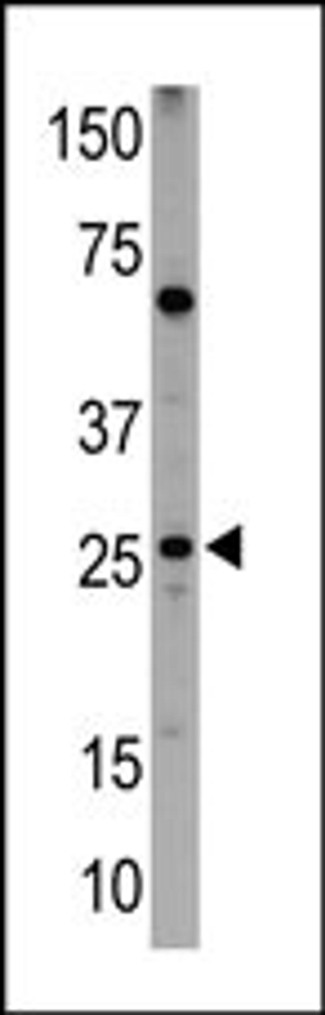 Western blot analysis of anti-NIP1 BH3 Domain Pab in HL60 cell lysates (35ug/lane).