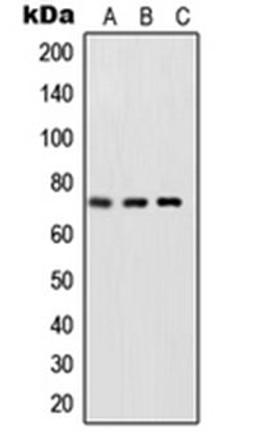 Western blot analysis of HeLa TNFa-treated (Lane 1), NIH3T3 LPS-treated (Lane 2), rat brain (Lane 3) whole cell lysates using RELA antibody