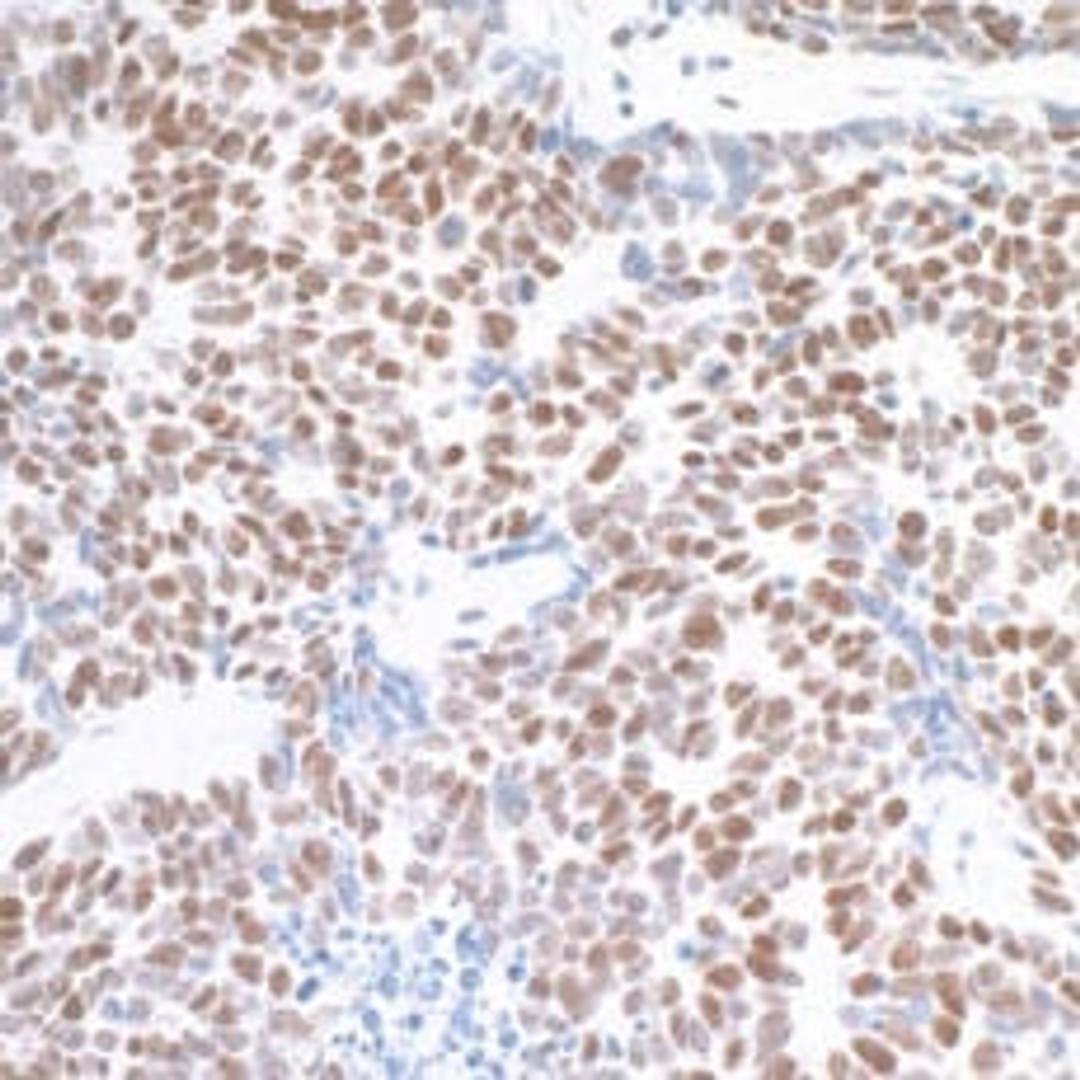 Detection of human MED1 by immunohistochemistry.