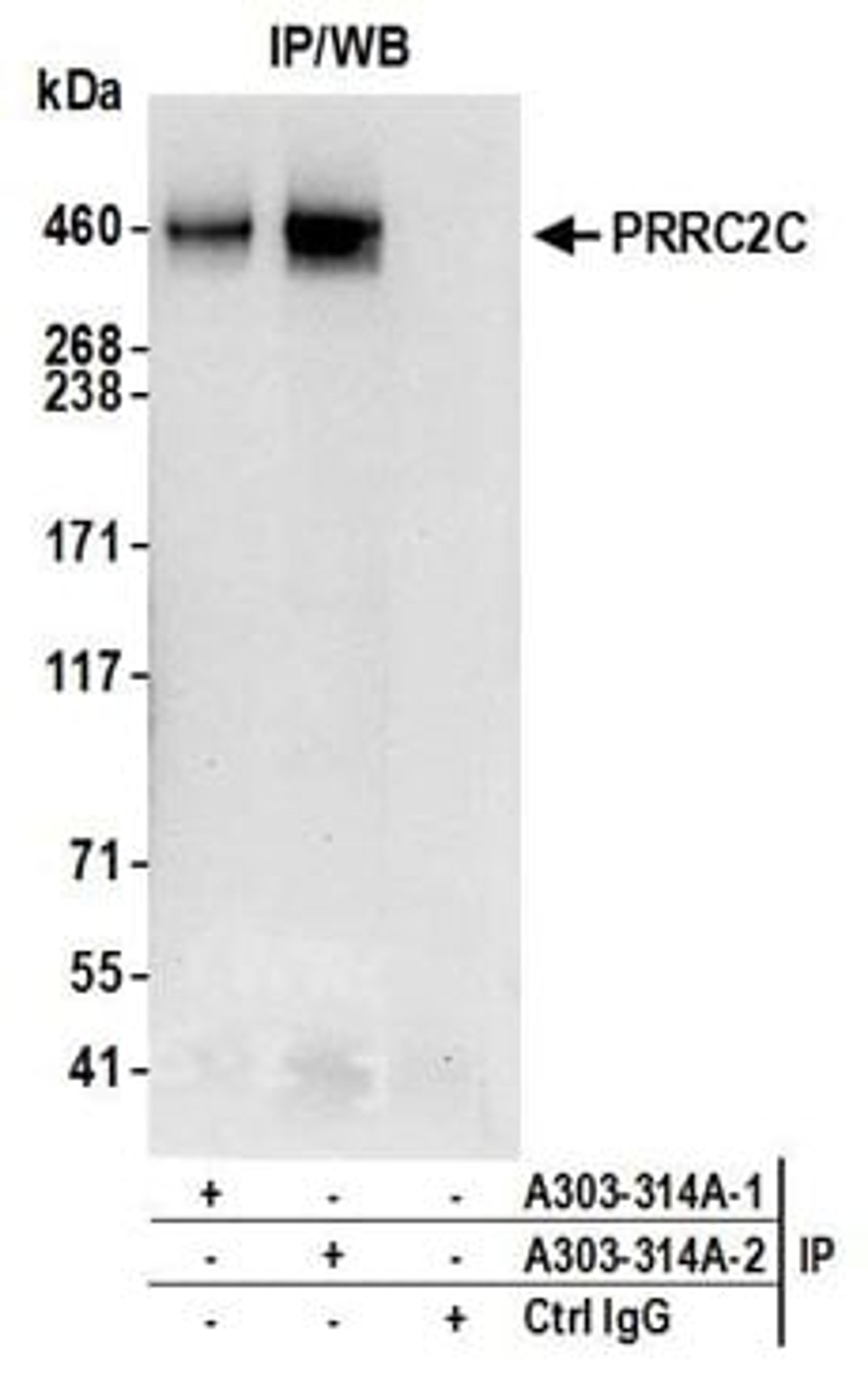 Detection of human PRRC2C by western blot of immunoprecipitates.