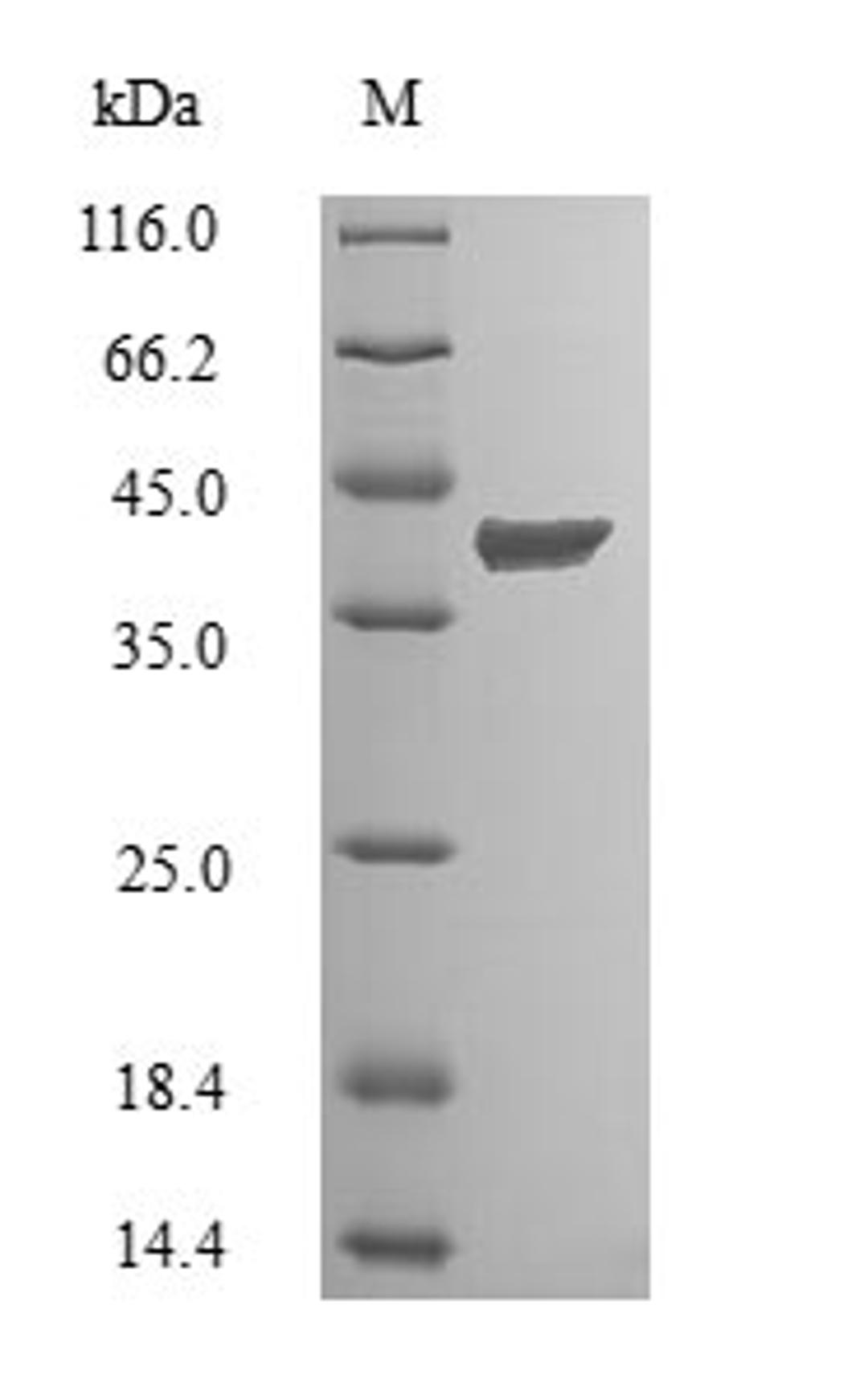 (Tris-Glycine gel) Discontinuous SDS-PAGE (reduced) with 5% enrichment gel and 15% separation gel.