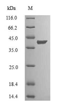 (Tris-Glycine gel) Discontinuous SDS-PAGE (reduced) with 5% enrichment gel and 15% separation gel.