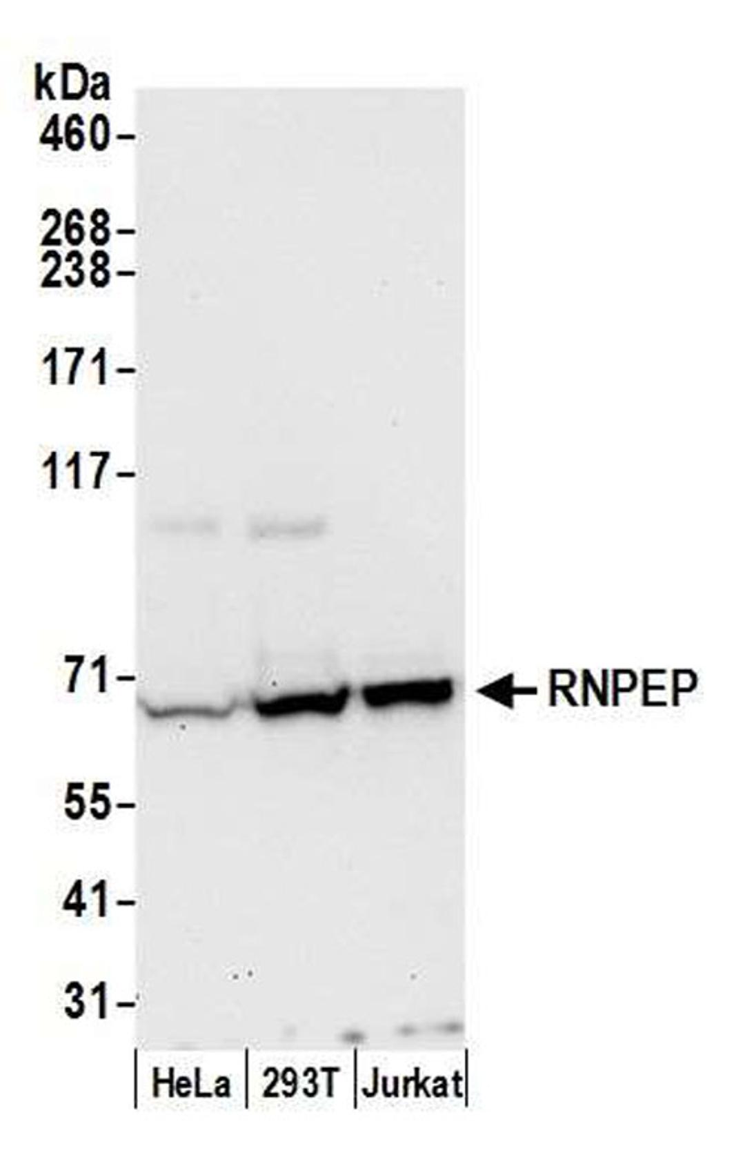 Detection of human RNPEP by WB.