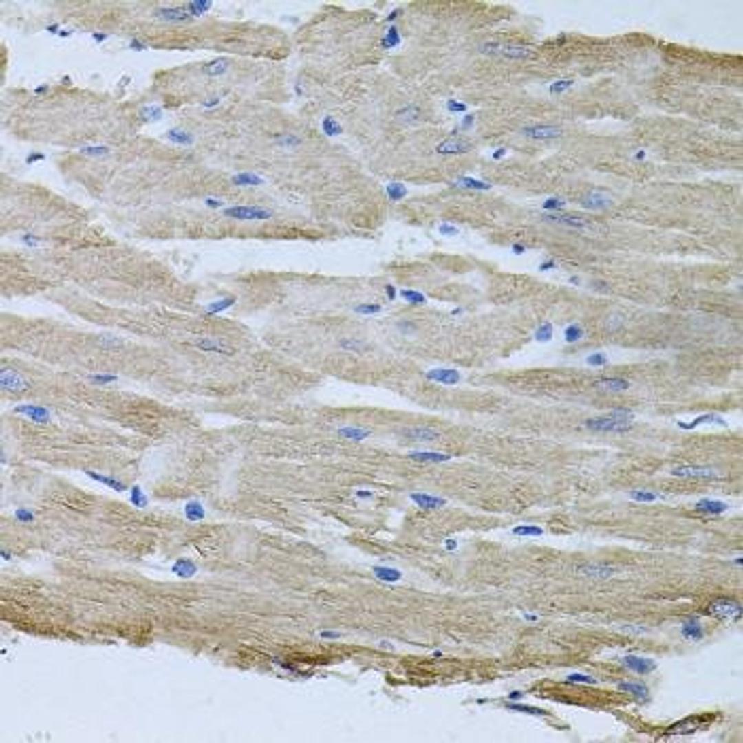 Immunohistochemical staining of mouse kidney tissue using TARS antibody (dilution of 1:100)