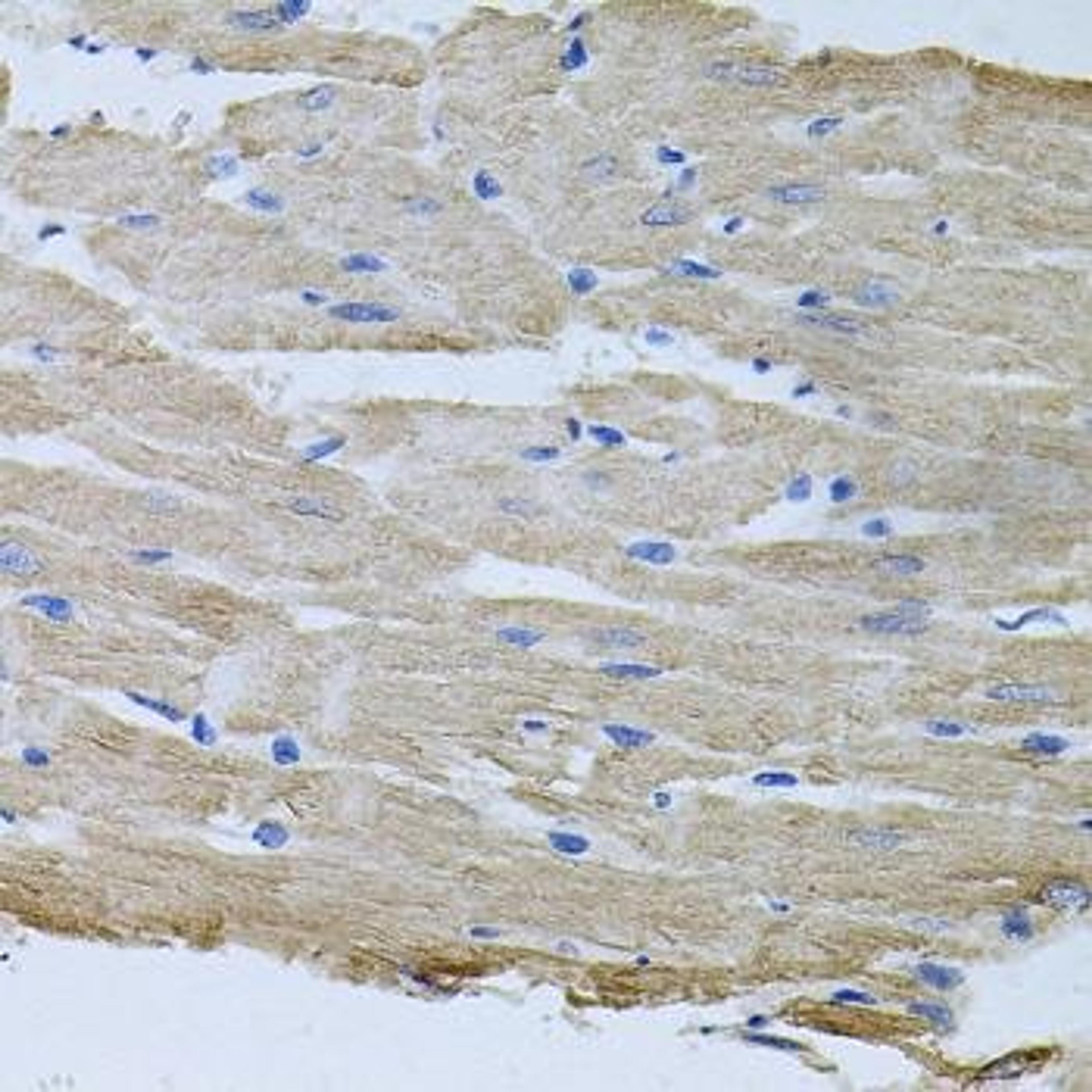 Immunohistochemical staining of mouse kidney tissue using TARS antibody (dilution of 1:100)