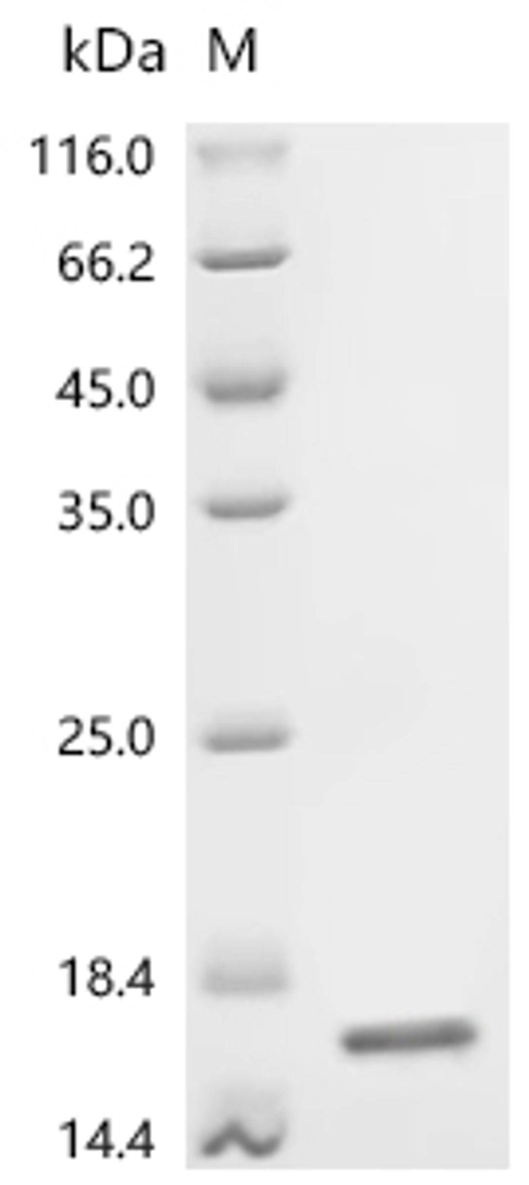 (Tris-Glycine gel) Discontinuous SDS-PAGE (reduced) with 5% enrichment gel and 15% separation gel.
