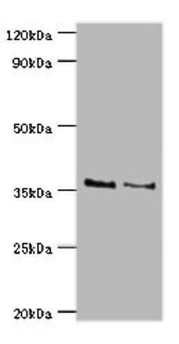 Western blot. All lanes: HOXA1 antibody at 2ug/ml. Lane 1: NIH/3T3 whole cell lysate. Lane 2: Hela whole cell lysate. Secondary. Goat polyclonal to rabbit IgG at 1/10000 dilution. Predicted band size: 37, 15, 25 kDa. Observed band size: 37 kDa. 