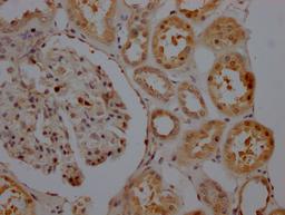 IHC image of CSB-RA156557A0HU diluted at 1:100 and staining in paraffin-embedded human kidney tissue performed on a Leica BondTM system. After dewaxing and hydration, antigen retrieval was mediated by high pressure in a citrate buffer (pH 6.0). Section was blocked with 10% normal goat serum 30min at RT. Then primary antibody (1% BSA) was incubated at 4℃ overnight. The primary is detected by a Goat anti-rabbit IgG polymer labeled by HRP and visualized using 0.05% DAB.