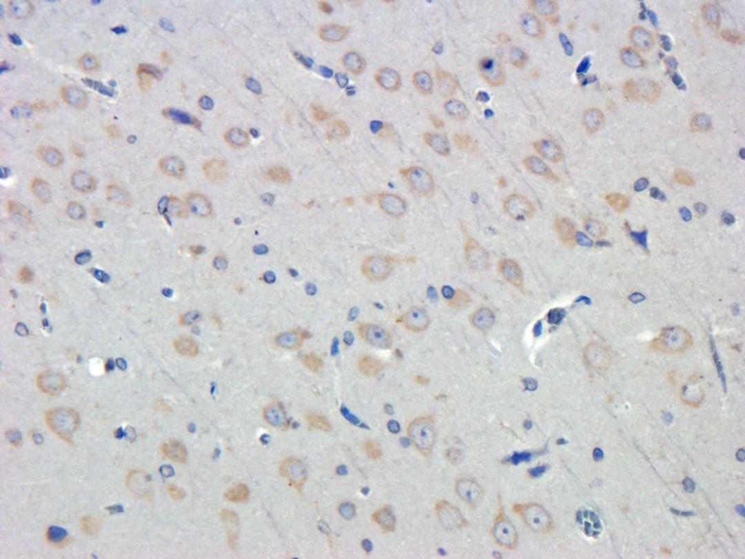 Immunohistochemical staining of rat brain tissue using LOX-1 antibody (dilution of primary antibody - 1:100)