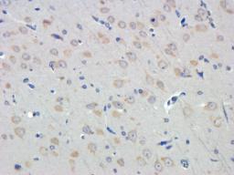 Immunohistochemical staining of rat brain tissue using LOX-1 antibody (dilution of primary antibody - 1:100)